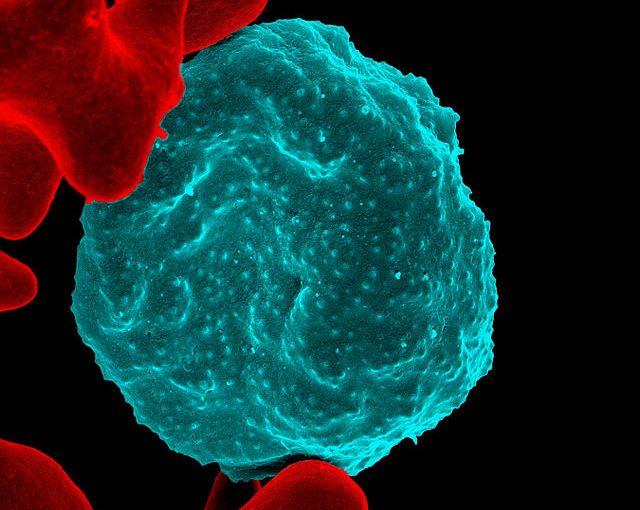 xuzhanghappy's tweet card. Scientists have identified a gene and a pattern of gene activation that helps malaria parasites coordinate to thwart the immune system and cause prolonged infections.