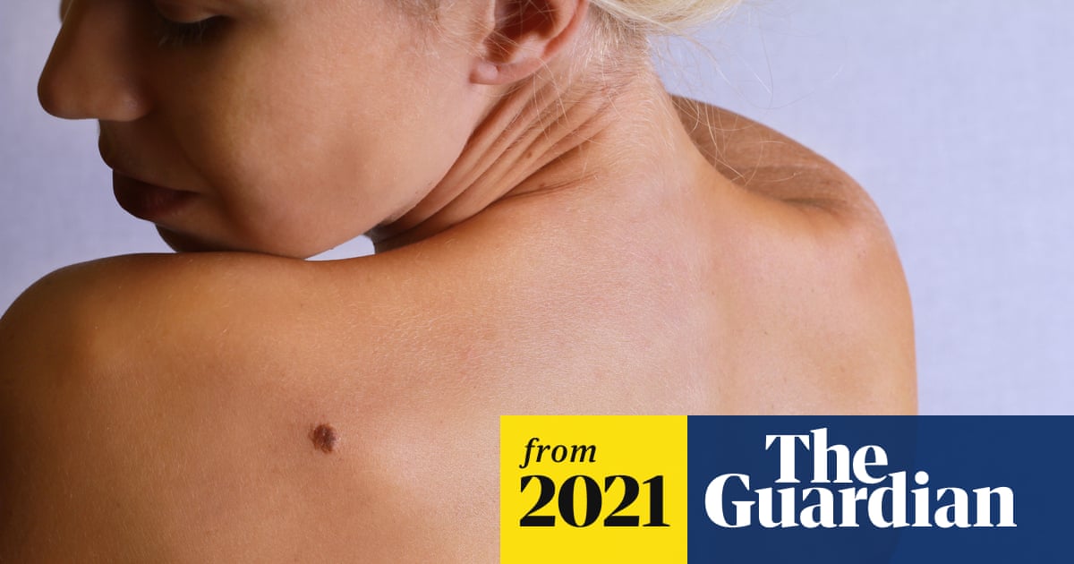 RISE_Projectuk's tweet card. Research finds few image databases available to develop technology contain details on ethnicity or skin type