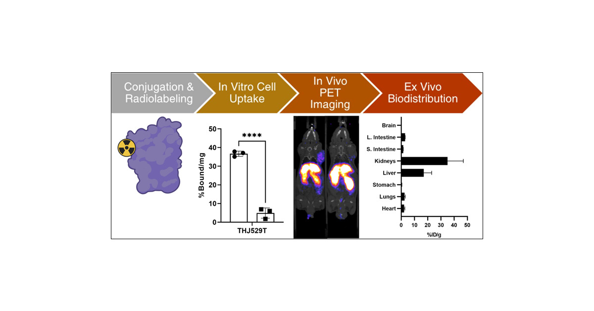 LapiSuzanne's tweet card. Thyroid cancer is the most common endocrine cancer, with differentiated thyroid cancers (DTCs) accounting for 95% of diagnoses. While most DTC patients are diagnosed and treated with radioiodine...