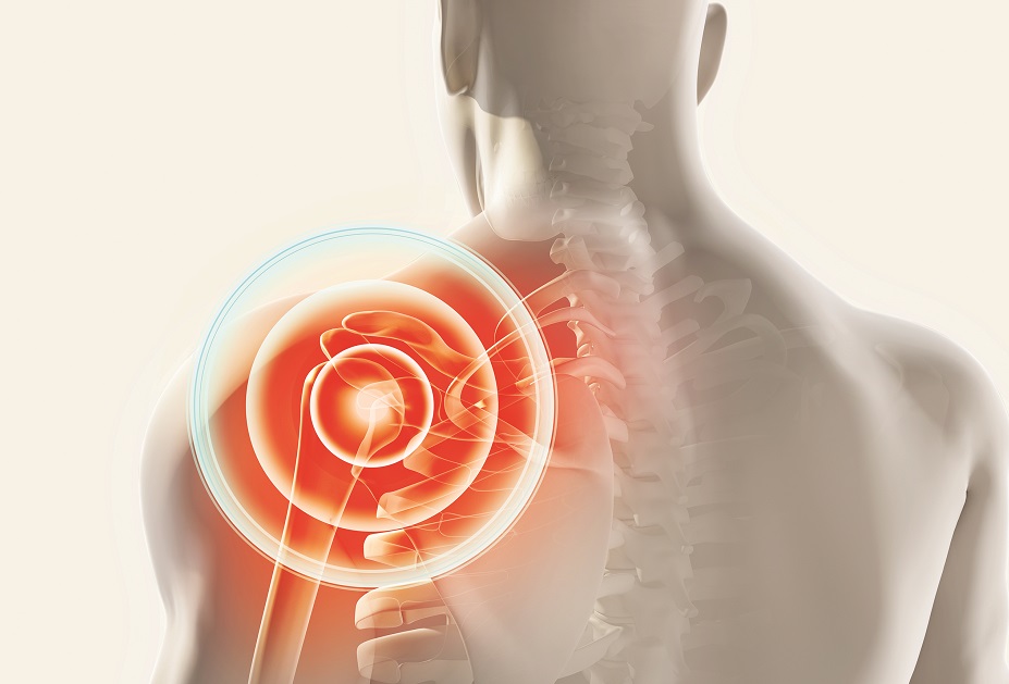 CodingSchoolInc's tweet card. Anatomy is important when applying bundling rules to procedures. The shoulder is a complex joint, and proper coding for shoulder procedures requires a The shoulder is a complex joint, and proper...