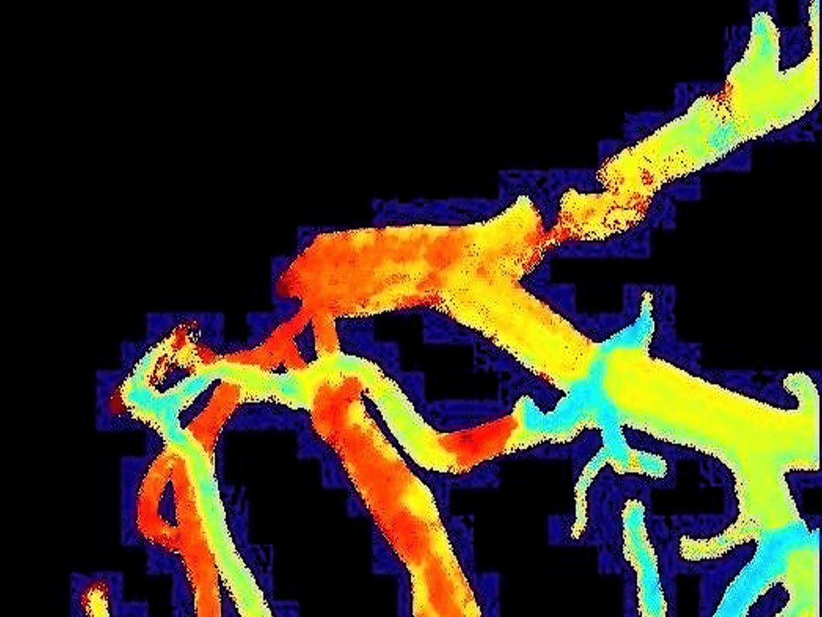 IEEESpectrum's tweet card. The BLEscope transmits in vivo imaging via Bluetooth