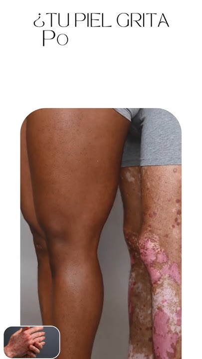 saludablecoffee's tweet card. ¿Tu piel grita por ayuda? Esta solución viene desde adentro | DXN...