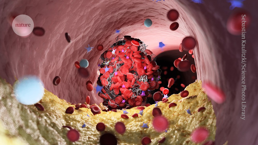 GMFHx's tweet card. Nature - Species in the human microbiome have enzymes that can metabolize a potentially dangerous lipid.