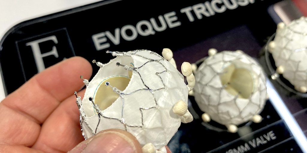 CardioBusiness's tweet card. When a 50-year-old patient developed severe TR just months after receiving a heart transplant, the safest treatment option was to implant an Evoque TTVR device. 