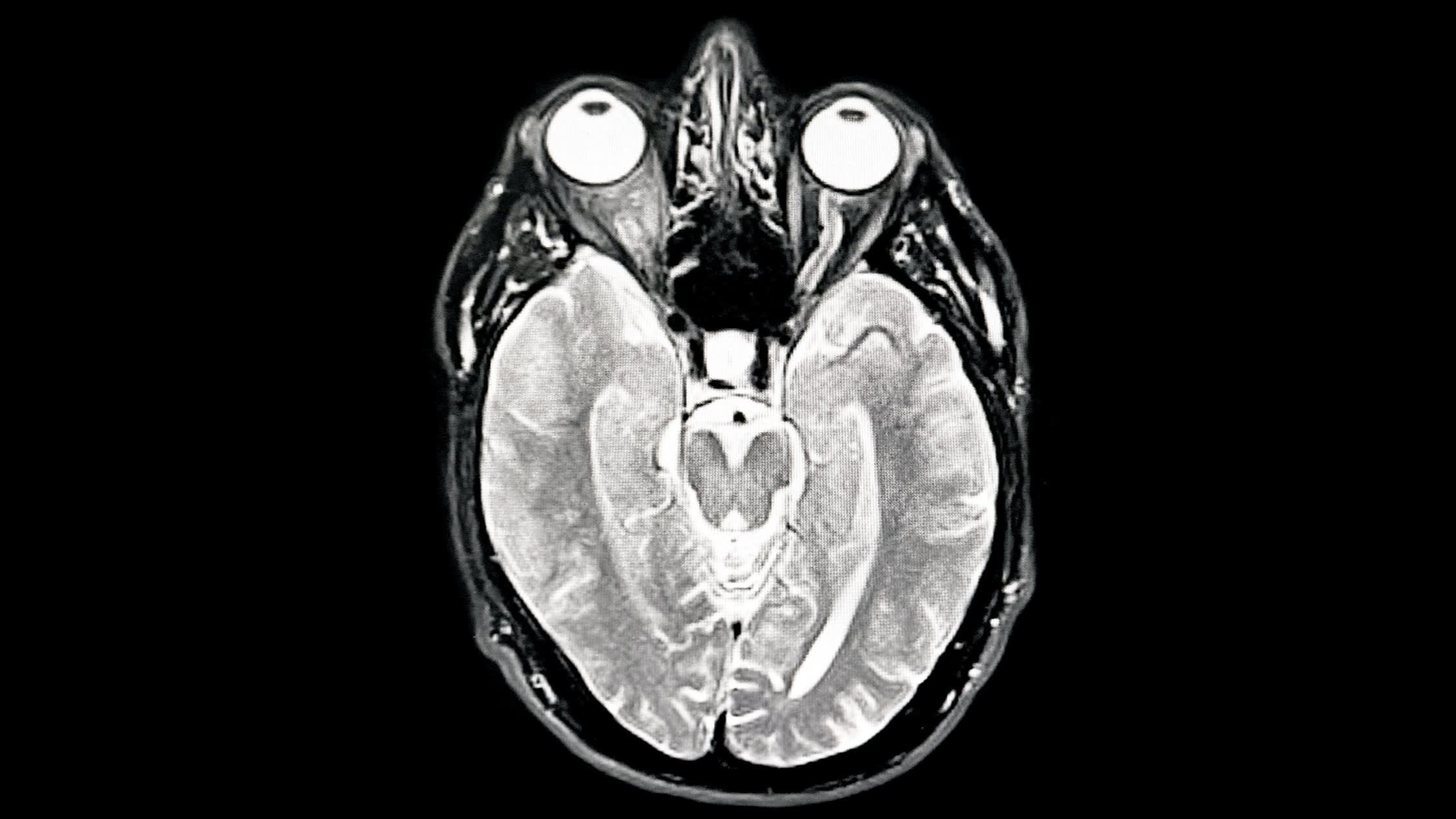 niranjanbose's tweet card. New competition is latest effort to deploy artificial intelligence to find cures for serious illnesses