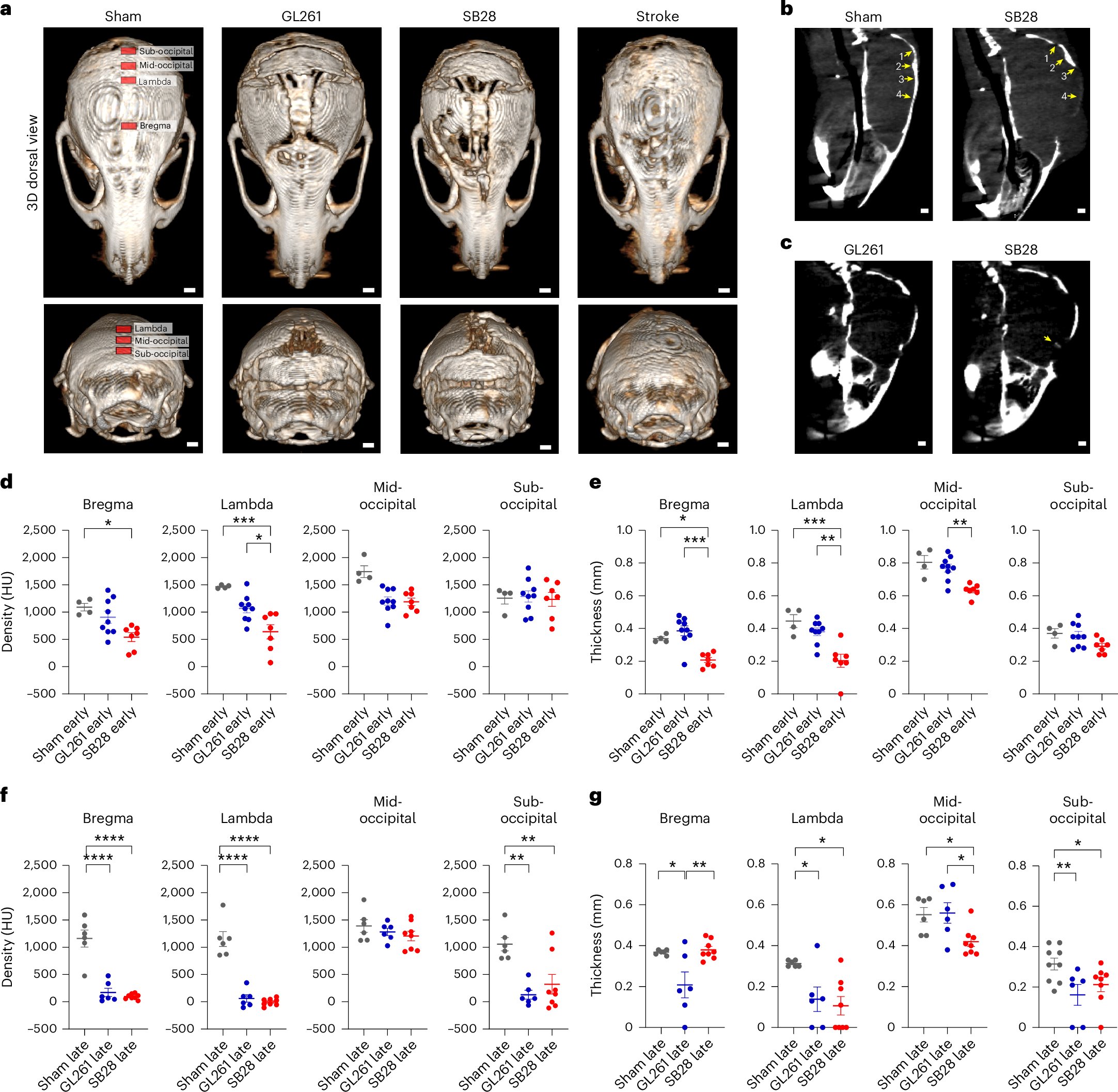 IFI_Einstein's tweet card. Nature Neuroscience - Glioblastoma—the deadliest form of brain cancer—alters the calvarial bone and its marrow components, pushing it toward producing more myeloid cells and...