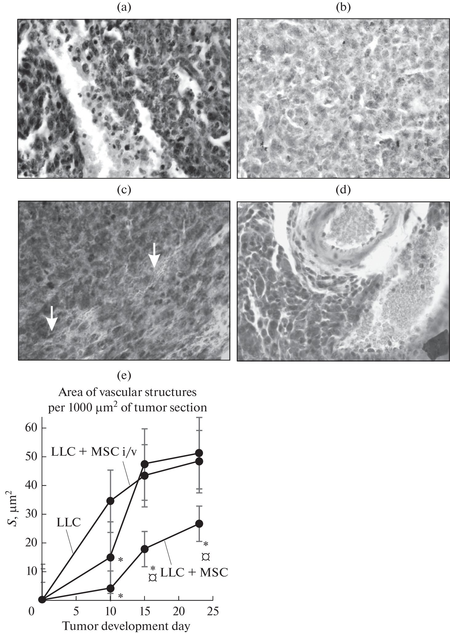 CytGen's tweet card. Cytology and Genetics - Morphological features of angiogenesis processes in Lewis lung carcinoma (LLC) regrowth tumors were investigated and analyzed during their independent development and under...