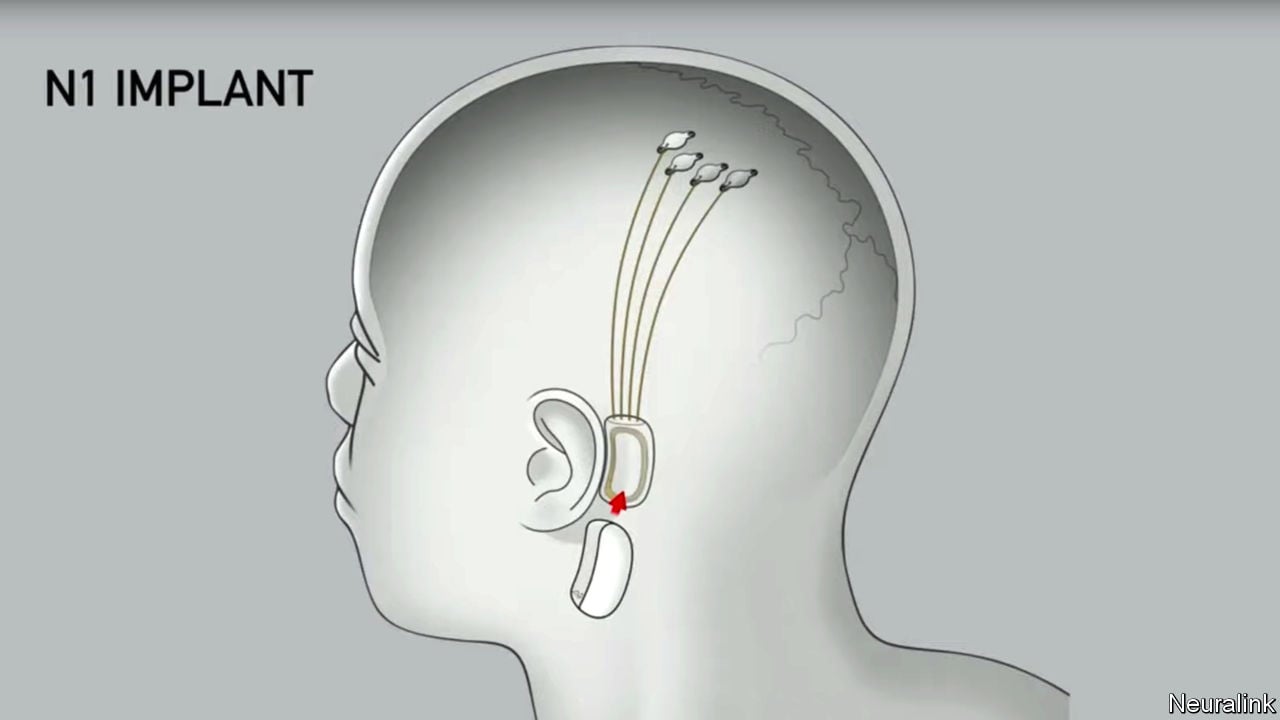 TheEconomist's tweet card. A device worn behind the ear might send your thoughts to your devices