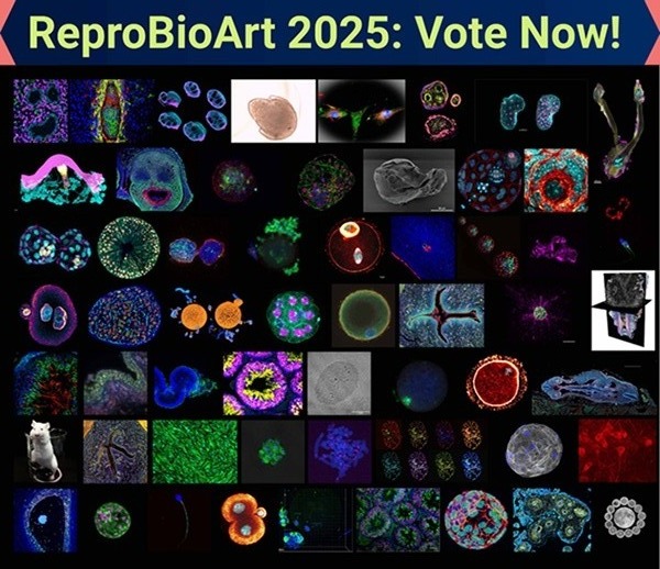 EwelinaBolcunF's tweet card. #ReproBioArt: Where science becomes art. Explore incredible images from reproductive biology research and consider submitting your own to win free registration to SSR 2026! @SSRrepro