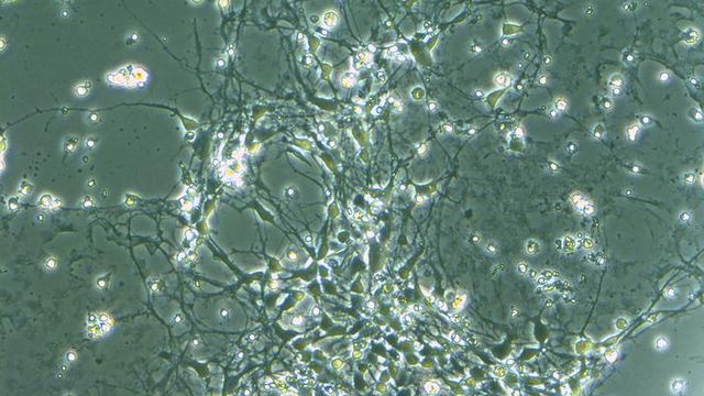 ToruTakumi's tweet card. Researchers have created 63 genetically engineered mouse stem cell lines to study autism-related mutations, especially copy number variations (CNVs). The library reveals shared protein production...