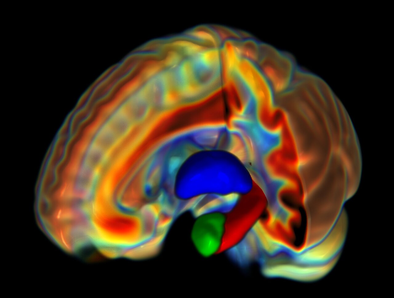 udaydream2's tweet card. A team of neuroscientists and behavioral specialists affiliated with several institutions in the U.S., working with one colleague from New Zealand and another from Canada, has found differences...