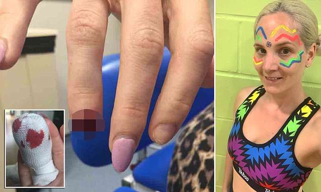 FingerProtector's tweet card. WARNING GRAPHIC CONTENT: Kelly Kay, of Sittingbourne, Kent, had to pull out of her exercise session after she had to go to hospital for plastic surgery when she amputated her finger.