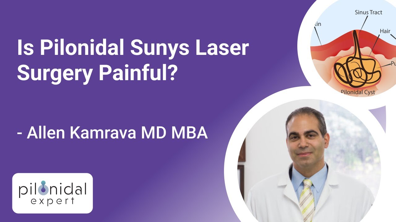 pilonidalexpert's tweet card. Is Pilonidal Sunys Laser Surgery Painful?