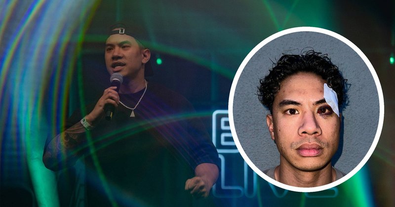 Tweet card summary image