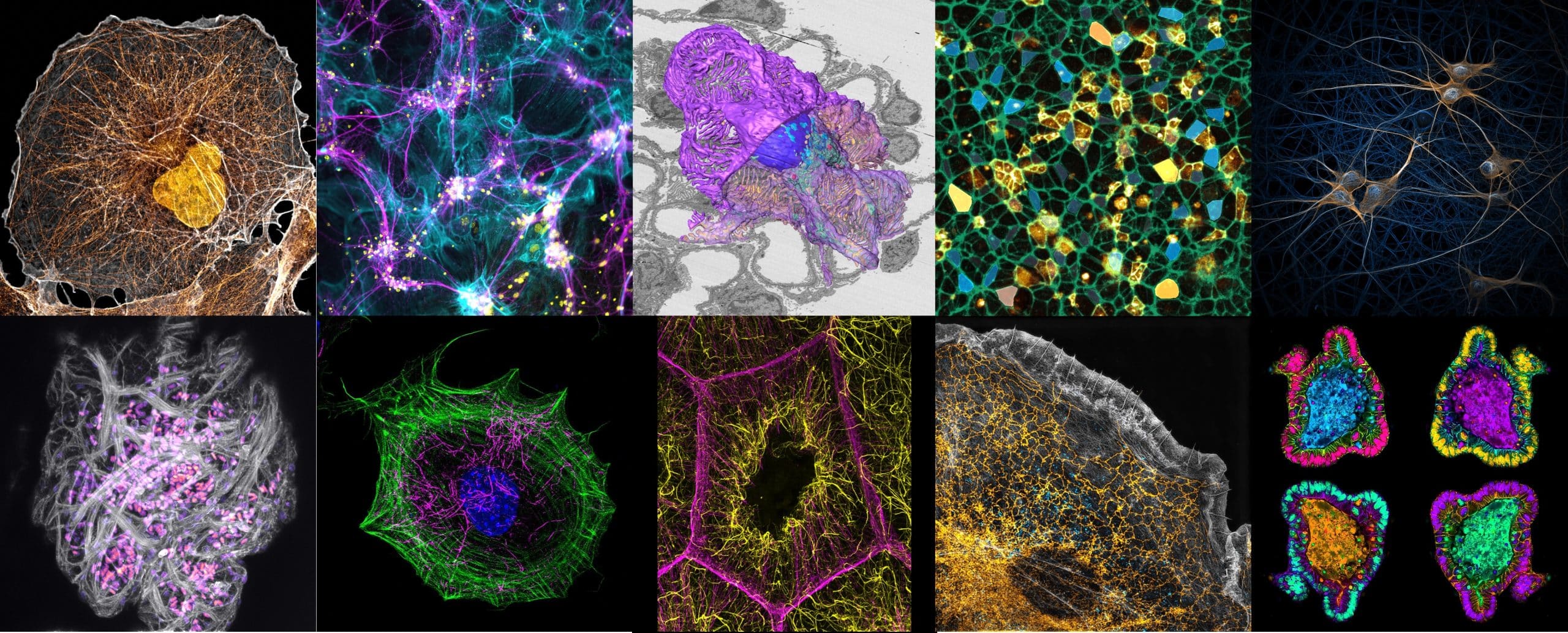 focalplane_jcs's tweet card. Vote for the cover - #JCSImagingSI - Discussions