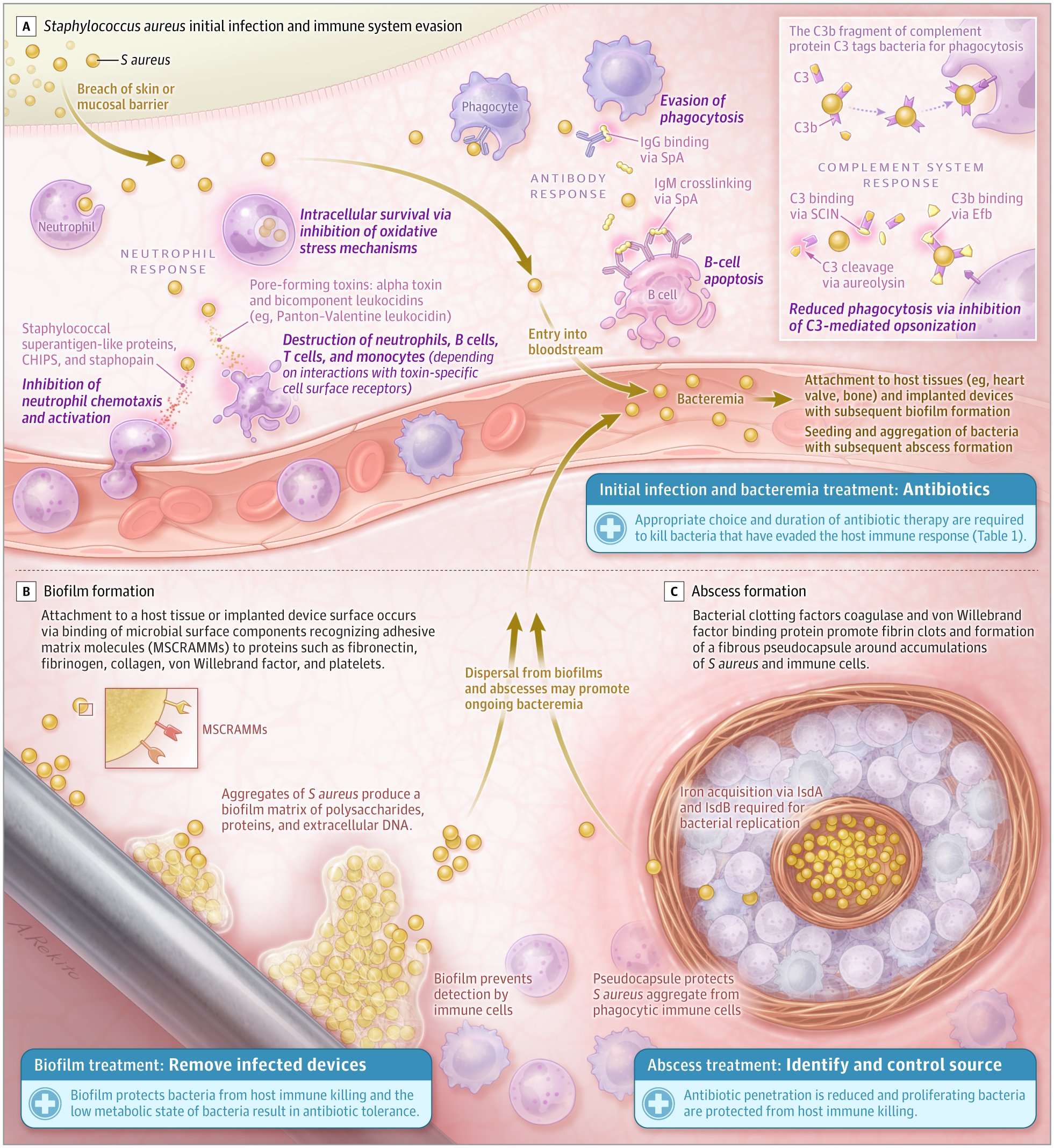 syctong's tweet card. This narrative review summarizes current evidence on the epidemiology, pathophysiology, clinical presentation, diagnosis, and treatment of Staphylococcus aureus bacteremia.