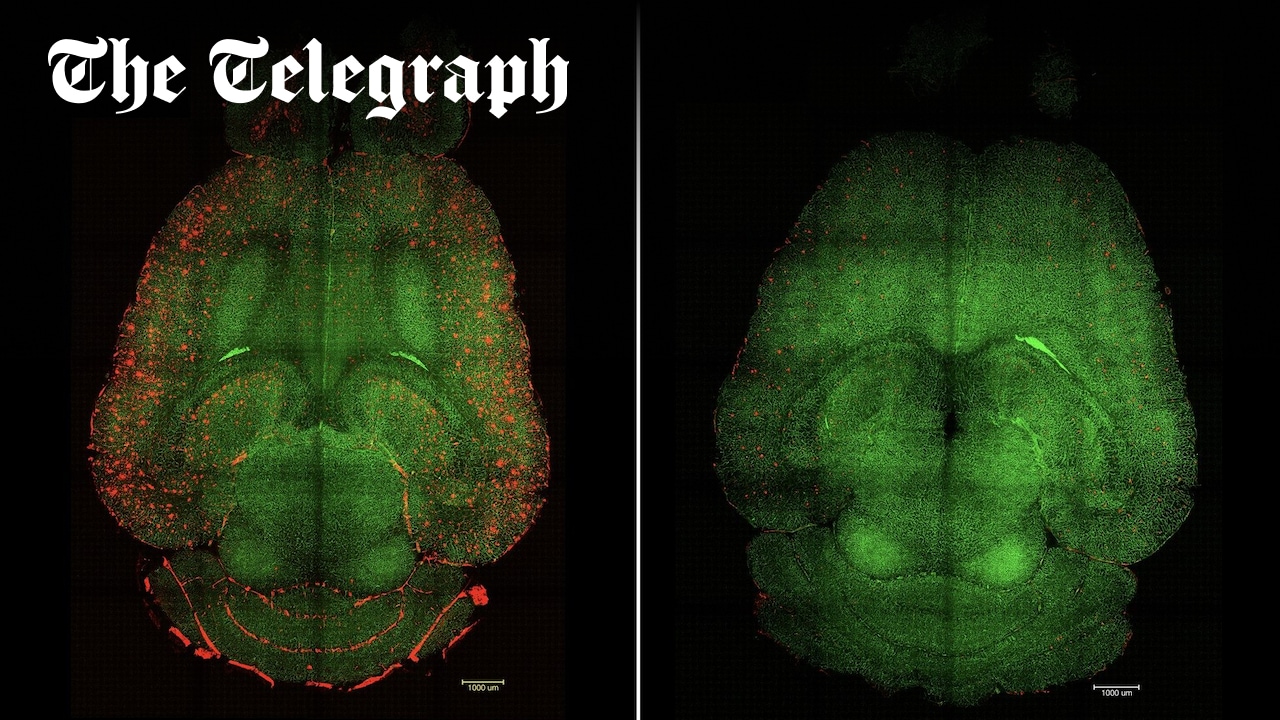 PerceptionsTod1's tweet card. Injection of nanoparticles “reminds” blood-brain barrier to work properly, allowing brain cells to communicate again