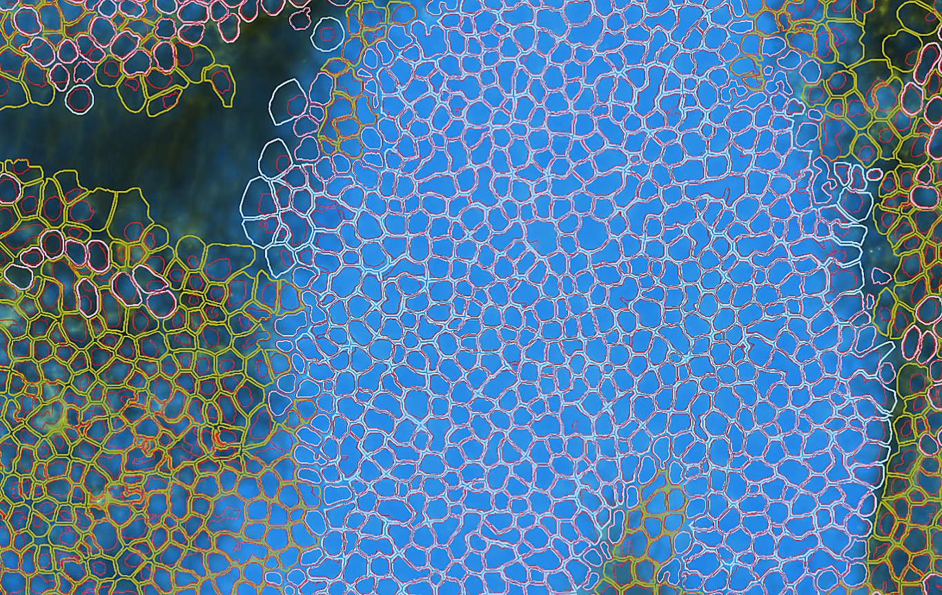 10xGenomics's tweet card. Explore improvements to the Xenium software ecosystem, including faster, self-serve custom panel design and an integrated staining and algorithmic approach to cell segmentation.