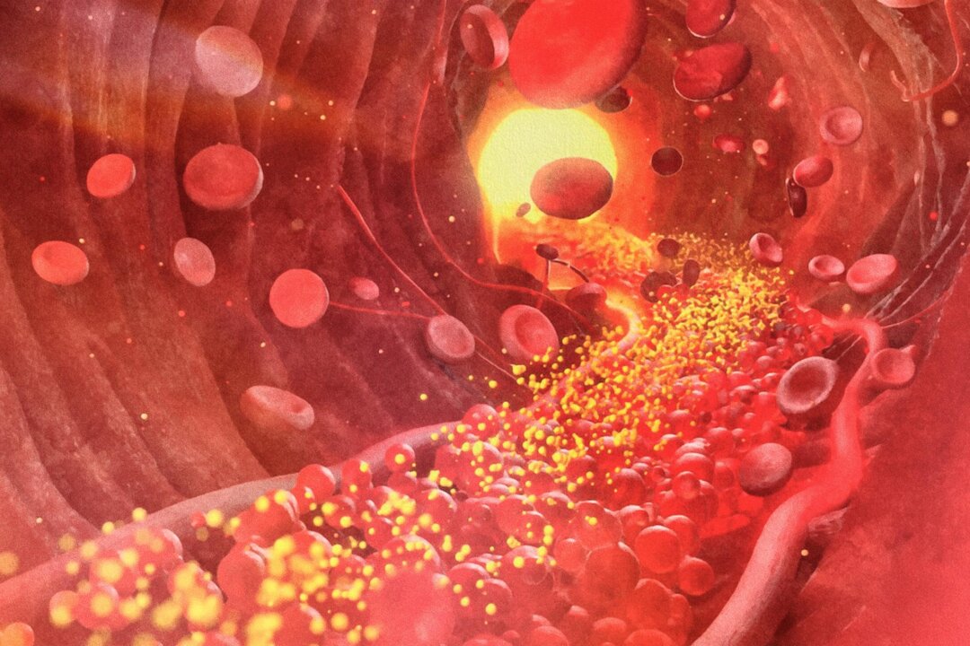 epochhealth's tweet card. Advanced lipid testing and other markers can reveal key aspects of metabolic health, according to the experts.