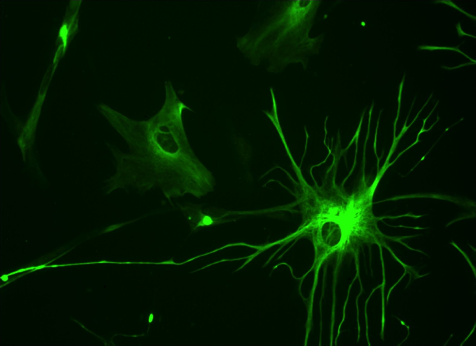 NeuroNow's tweet card. New study finds long-overlooked cells help the brain respond to visual stimuli.