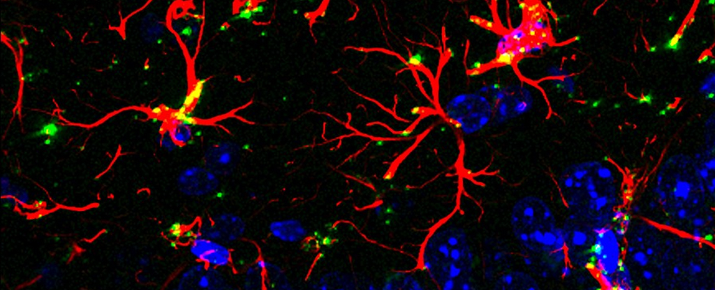 ScienceAlert's tweet card. A protein that can reverse cognitive decline?