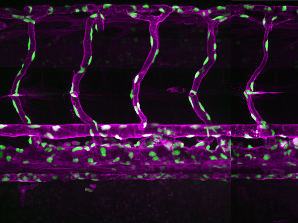 riken_en's tweet card. RIKEN researchers have shown that that hydrostatic pressure is one of two mechanisms that control endothelial cell migration during angiogenic sprouting in zebrafish