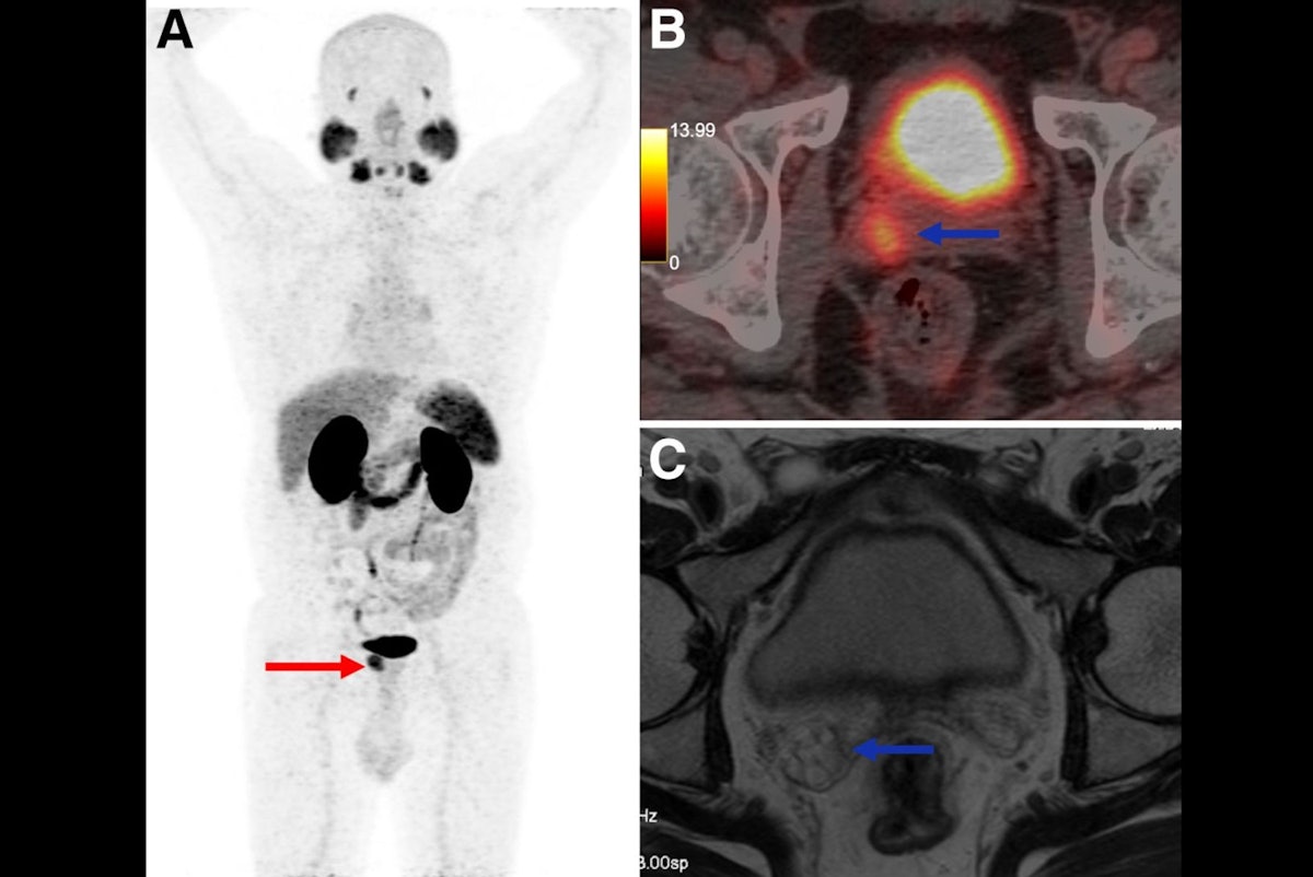 Sid_Healthcare's tweet card. A global trial sponsored by the International Atomic Energy Agency (IAEA) supports the adoption of prostate-specific antigen (PSMA) PET/CT into standard staging protocols.