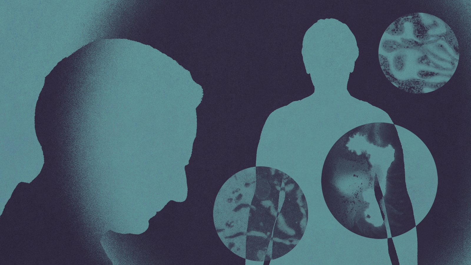 CSHL's tweet card. In the last decade, more than a dozen types of cancer have risen among people under 50. Scientists don’t have all of the answers, but research is starting to offer clues.