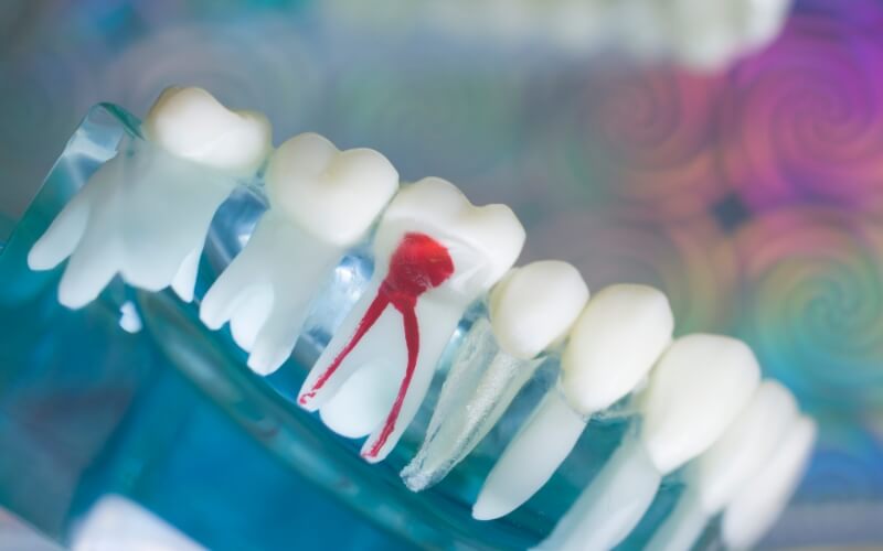 dentistnearyou's tweet card. Treatment options for irreversible pulpitis are numerous, with dentists directing their patients toward favoured therapeutic procedures. Getting the best outcome for your oral care may be determined...