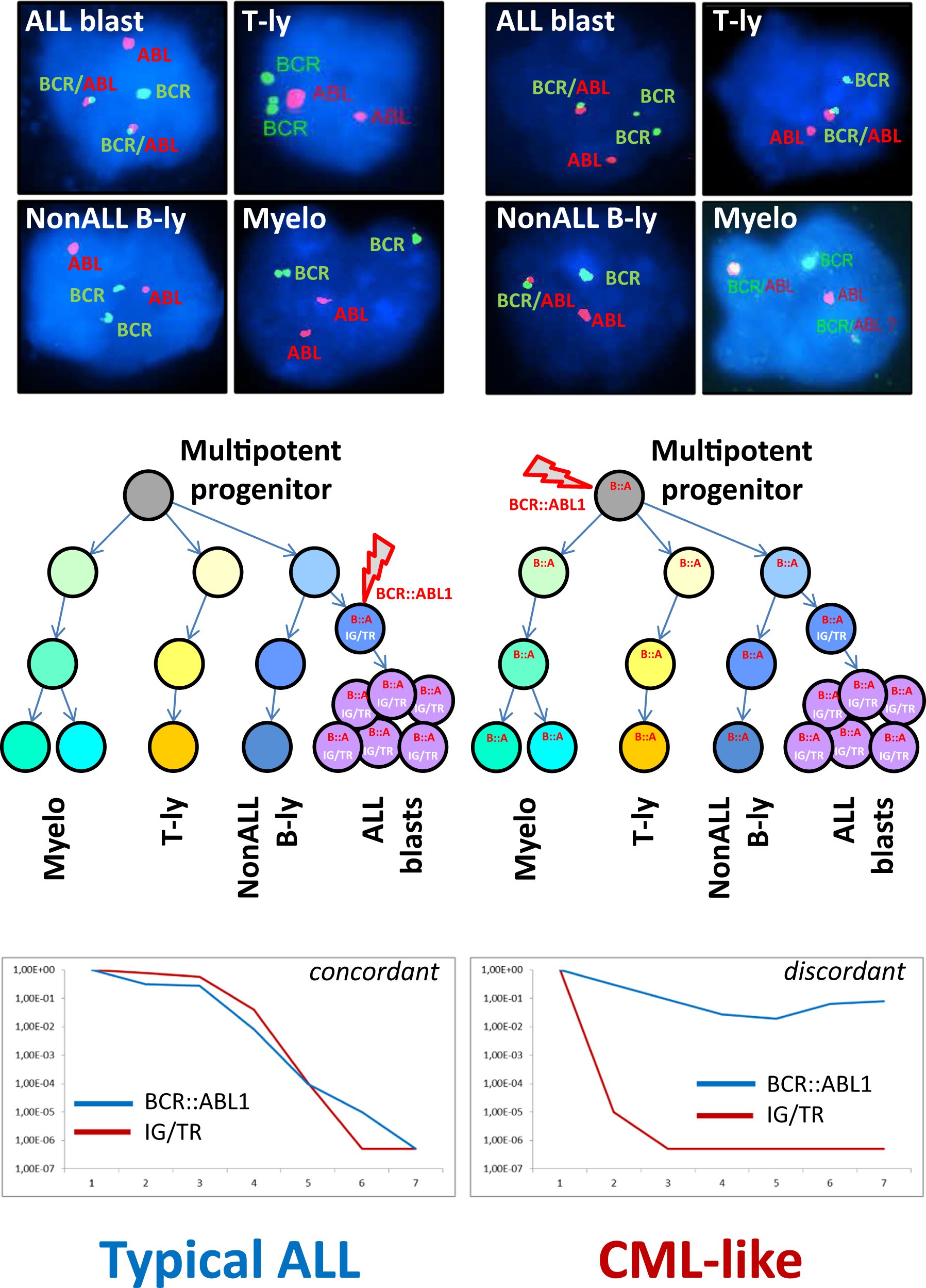 LeukDocWebster's tweet card. Leukemia - Minimal residual disease in BCR::ABL1-positive acute lymphoblastic leukemia: different significance in typical ALL and in CML-like disease