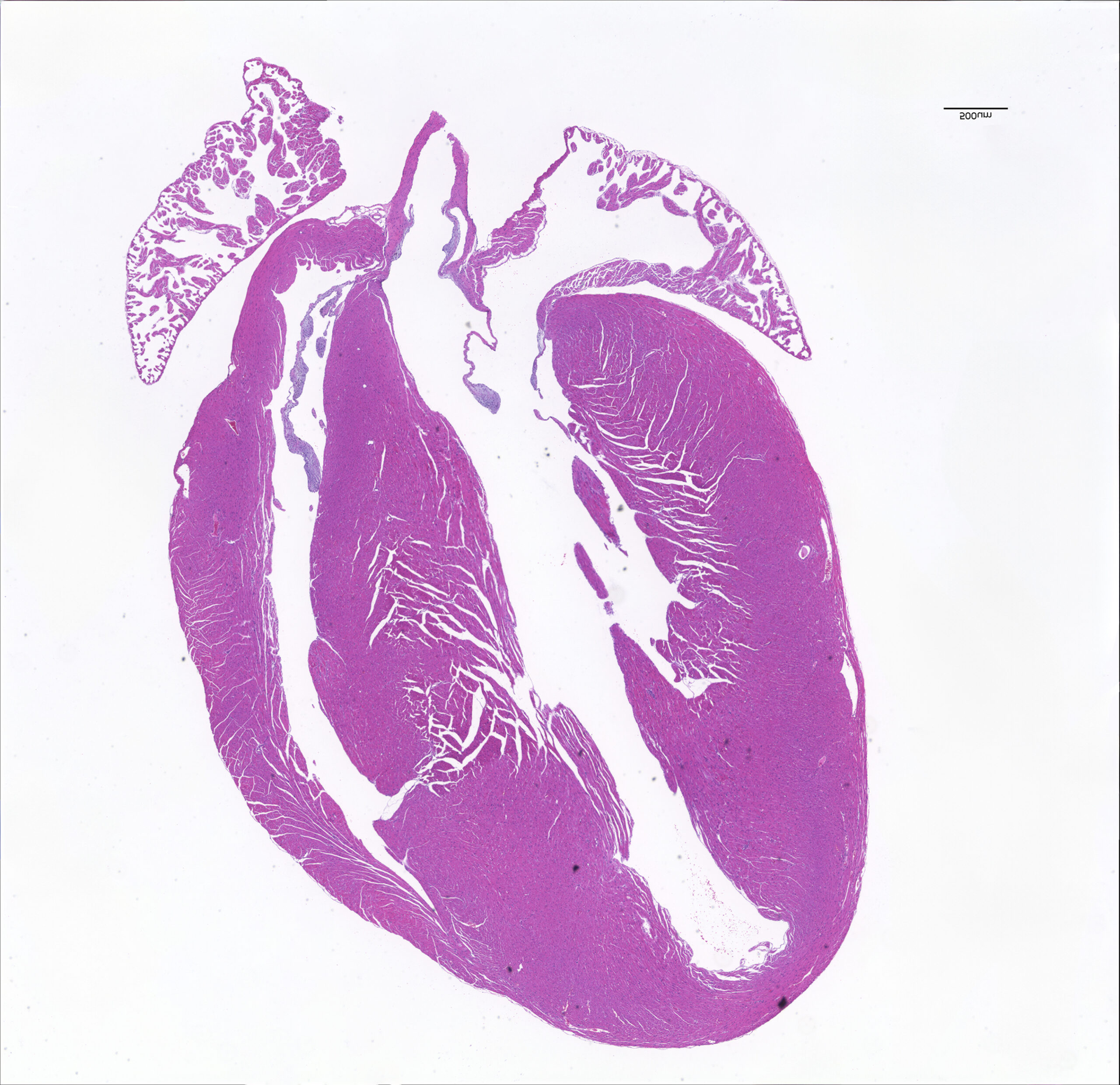 Inside_PM's tweet card. Precisely editing just a single nucleotide in the genome could help clinically correct cardiomyopathies, a proof-of-concept study suggests.