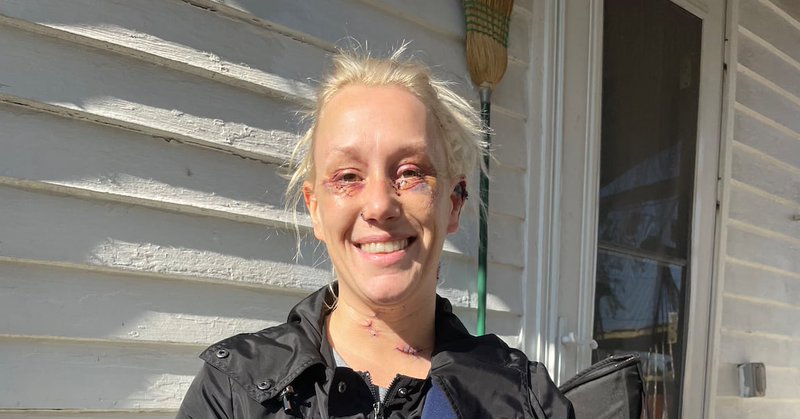 Tweet card summary image