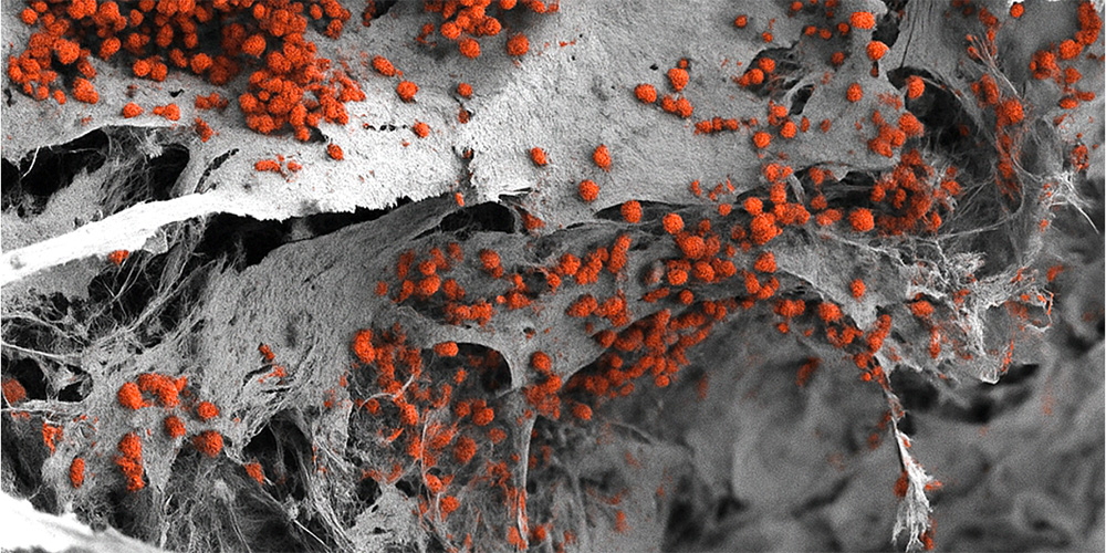 StopvivisectSvd's tweet card. Researchers are realistically recreating human bone marrow in the laboratory using artificial bone structures and human cells.