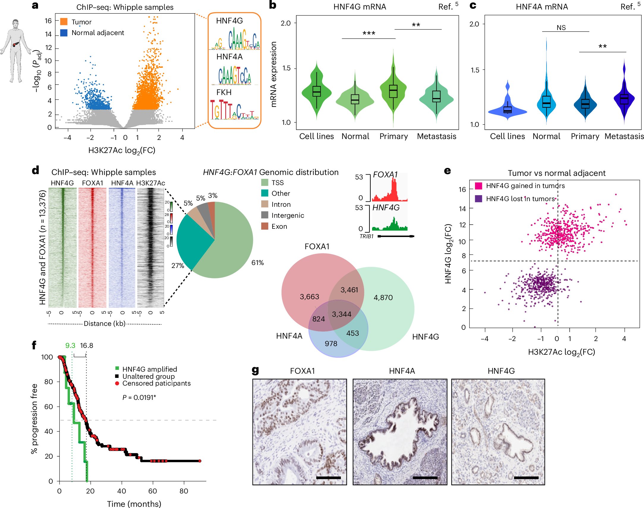 shalvrao's tweet card. Nature Genetics - Pancreatic cancer progression is driven by a switch from HNF4G-driven transcriptional activity in primary disease to FOXA1-mediated transcription in the metastatic setting.