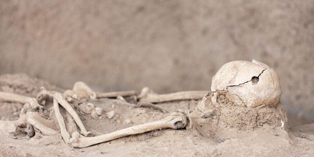 VTBCasts's tweet card. The trepanation tool, which looks like a blade on which the end point was sharpened into a spike, came from a site once inhabited by Celts.