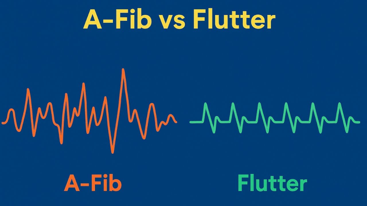 Bionichaos's tweet card. Exploring ECG Simulators: From Normal Rhythms to A-Fib & Mobitz...