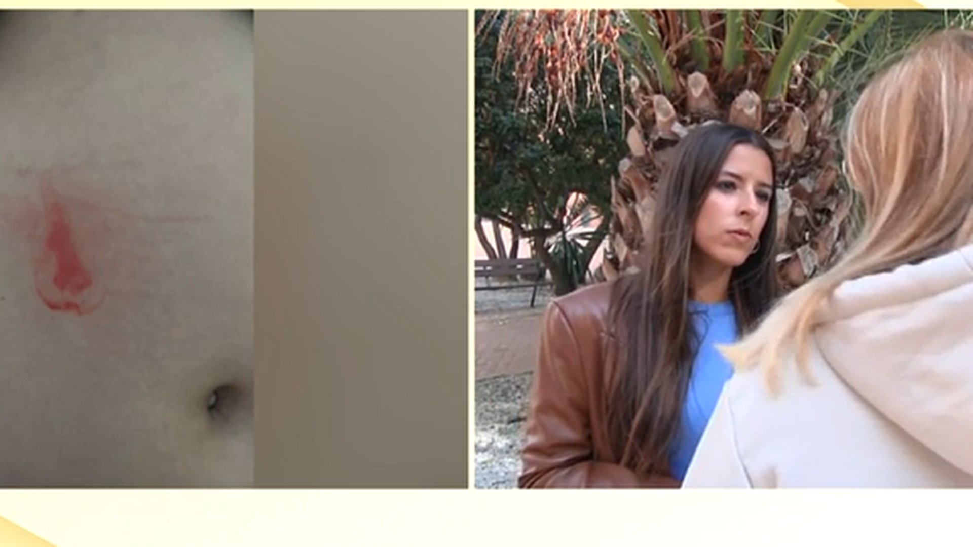 telecincoes's tweet card. Una niña de trece años con discapacidad está viviendo un tormento en su instituto : han intentado apuñalarla, la insultan a diario y la amenazan. Un