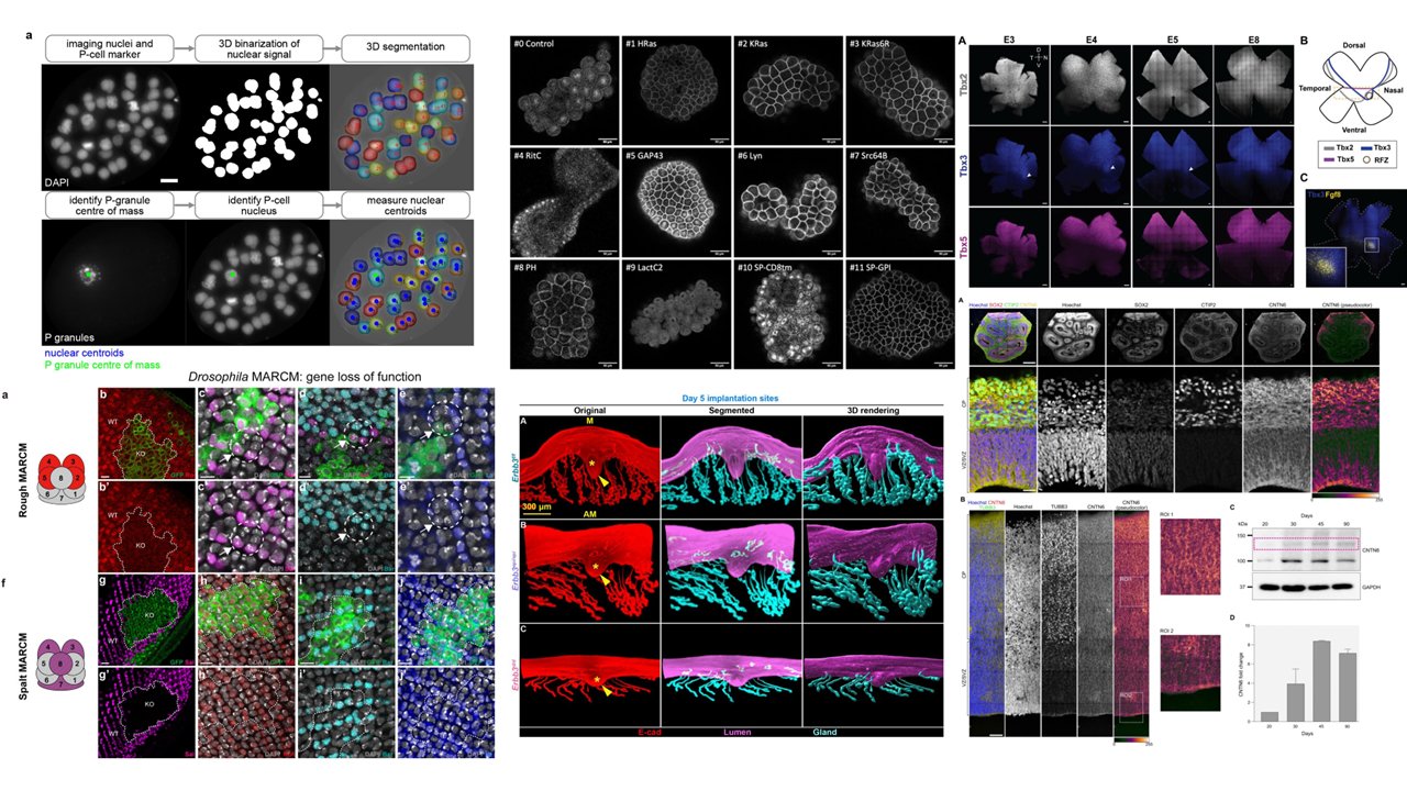 the_Node's tweet card. Welcome to our monthly trawl for developmental and stem cell biology (and related) preprints. The preprints this month are hosted on bioRxiv.