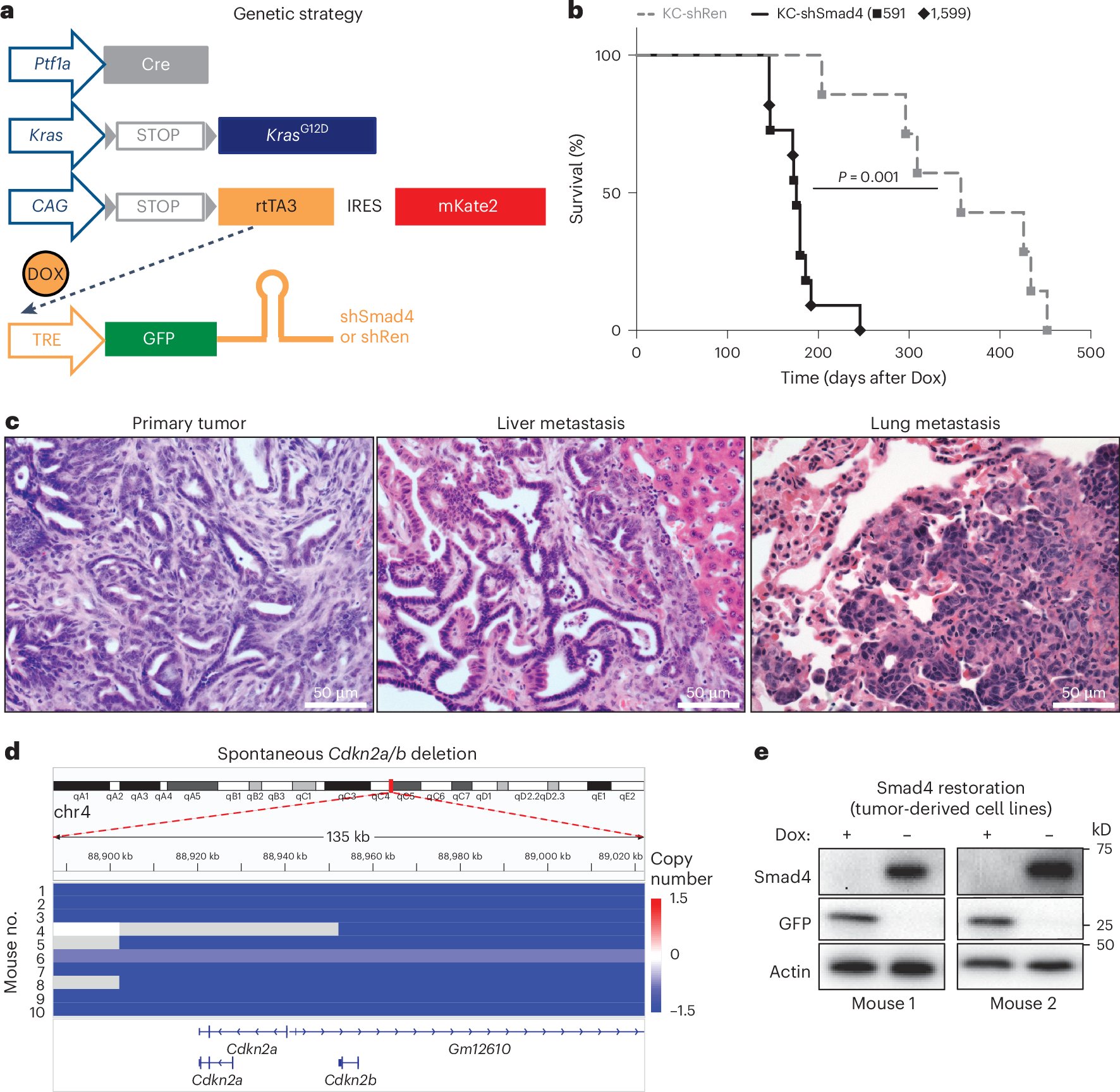 ktsanov's tweet card. Nature Cancer - Using mouse pancreatic cancer models, Tsanov et al. show that reactivation of SMAD4 at metastatic sites promotes tumor growth in the lung through RUNX1 but restrains metastatic...