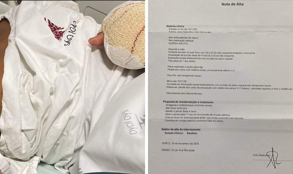 operamundi's tweet card. Uma criança brasileira de nove anos teve as pontas de três dedos da mão esquerda amputadas após sofrer uma agressão de colegas dentro da Escola Básica de Fonte Coberta, no distrito de Viseu, no norte...