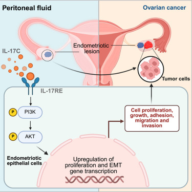 CellRepMed's tweet card. Yao et al. identify that IL-17C in peritoneal fluid drives endometriosis-associated carcinogenesis via IL-17RE/PI3K-mediated EMT. They demonstrate that blocking IL-17C-IL-17RE signaling suppresses...
