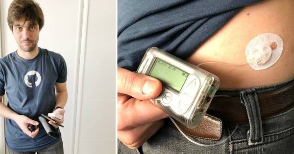 toniousx's tweet card. Una plataforma de código abierto permite que pacientes con conocimientos de informática desarrollen un sistema que les ayuda a controlar mejor su enfermedad