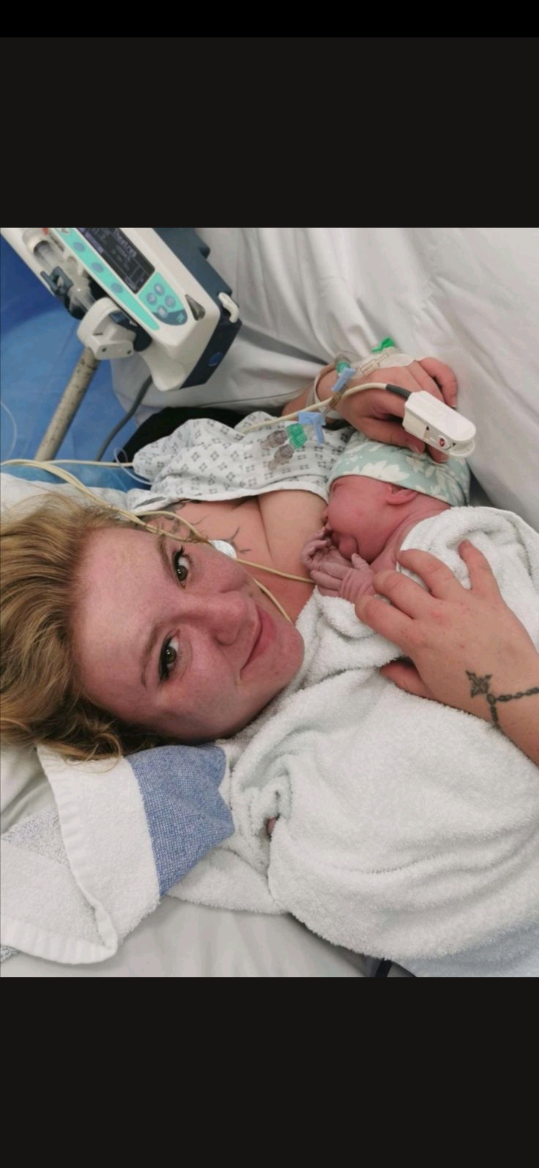 boobingit's tweet card. As if getting grips with breastfeeding isn't hard enough, breastfeeding after a c-section is a whole new ball game. Barriers to breastfeeding after a c-section There can be so many more barriers to...