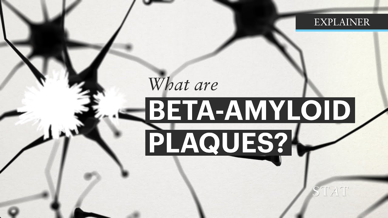 ReitzLab's tweet card. What are Beta-Amyloids plaques?