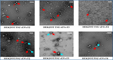 ExosomeRNA's tweet card. Small extracellular vesicles (sEVs) play essential roles in intercellular signaling both in normal and pathophysiological conditions. Comprehensive...