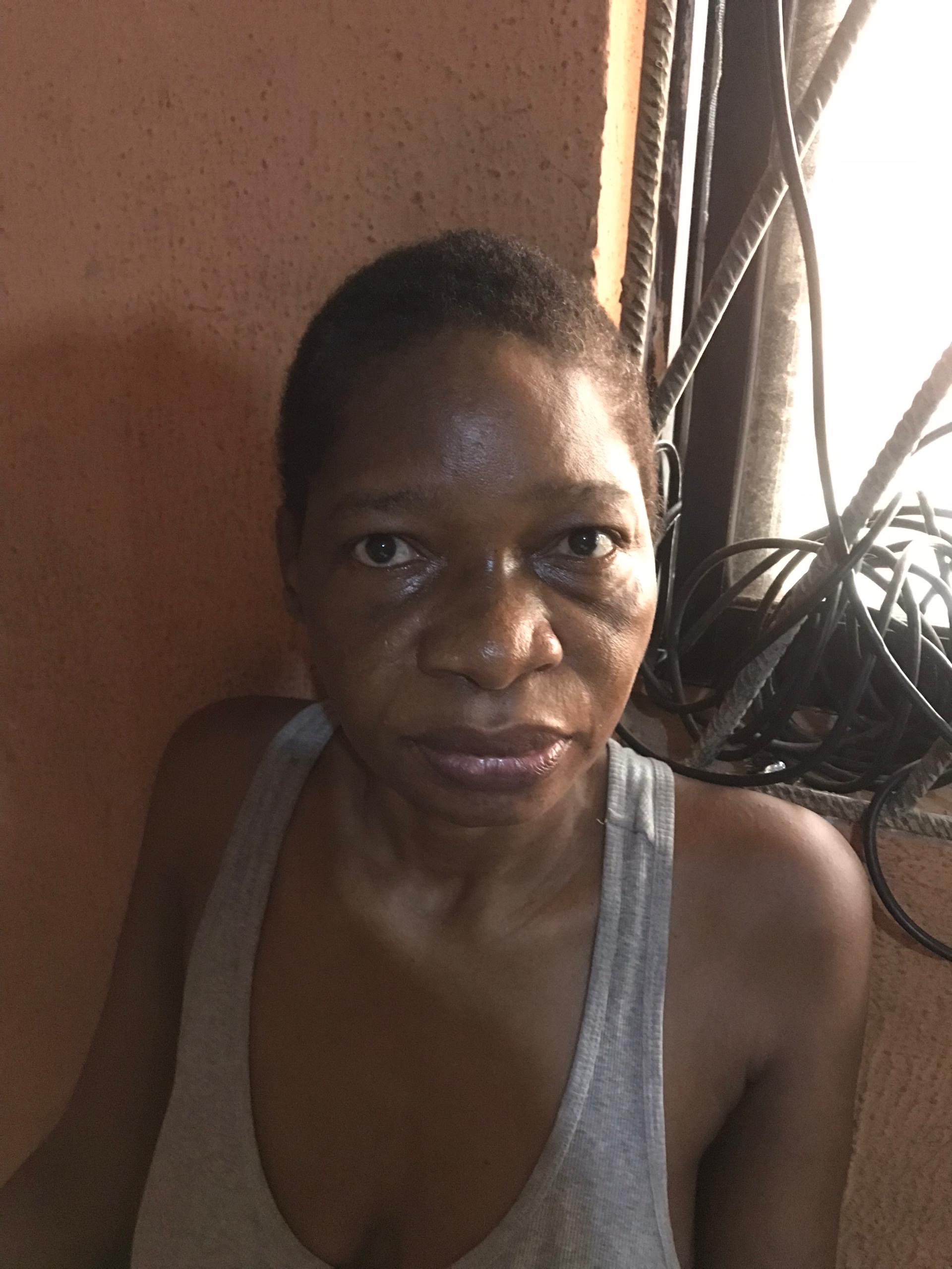 oncrowdr's tweet card. Hi, I’m Adesewa Oyenola and I’m raising funds to support my mum’s ongoing treatment for Amyotrophic Lateral Sclerosis (ALS) — a progressive neurological disease that affects the brain and spinal...