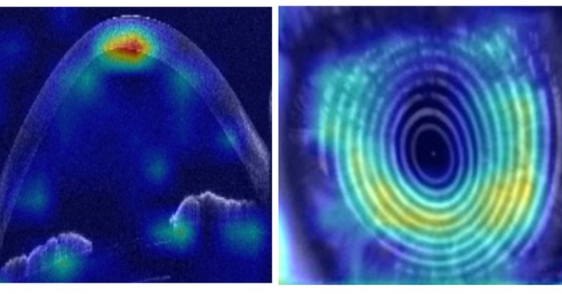 Tweet card summary image