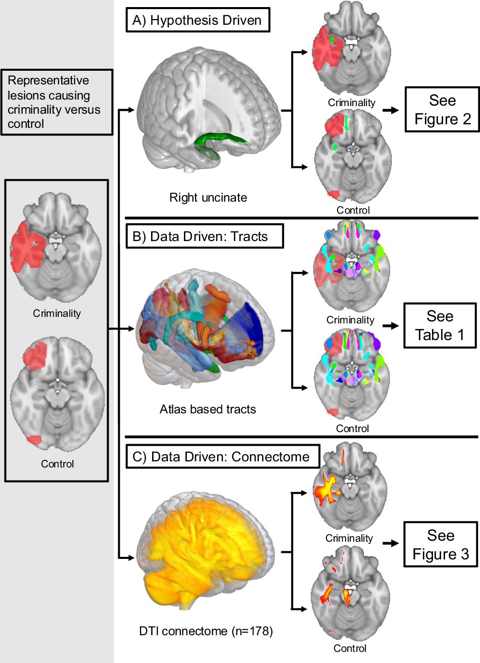 IsaiahNeurology's tweet card. Molecular Psychiatry - White matter disconnection in acquired criminality