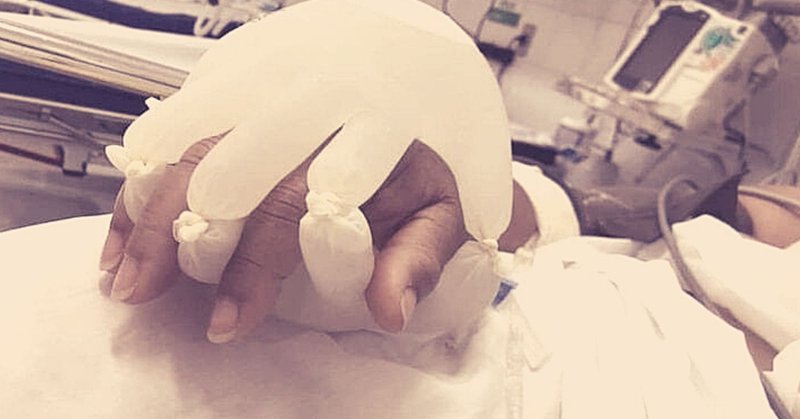 Tweet card summary image