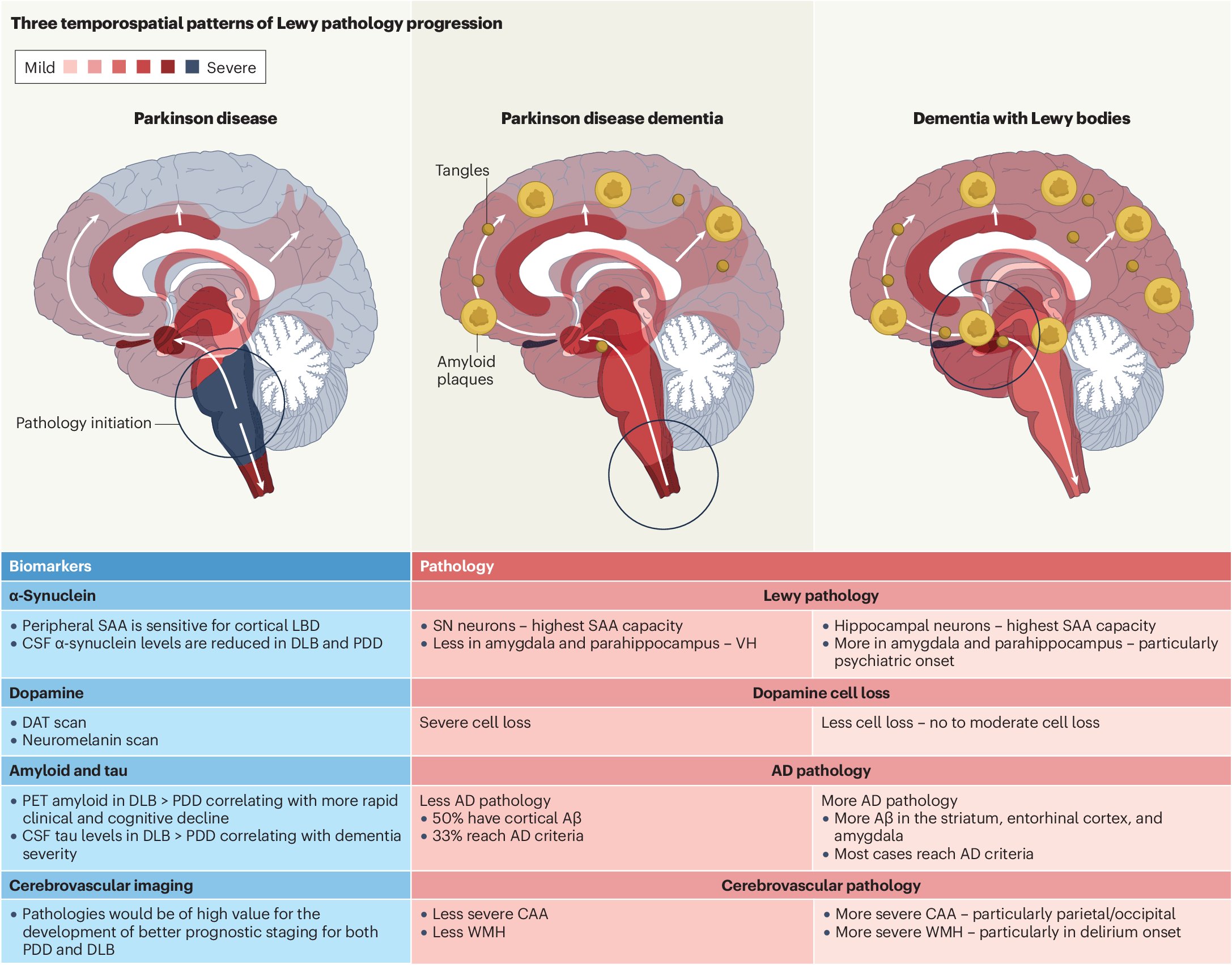 GreenJournal's tweet card. Nature Reviews Neurology - The development of α-synuclein biomarkers has raised debate as to whether Parkinson disease dementia and dementia with Lewy bodies should fall under a single...